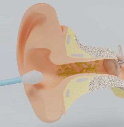 EarVision Pro™ – Slimme Oorreiniger met Camera