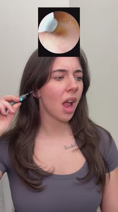 EarVision Pro™ – Slimme Oorreiniger met Camera